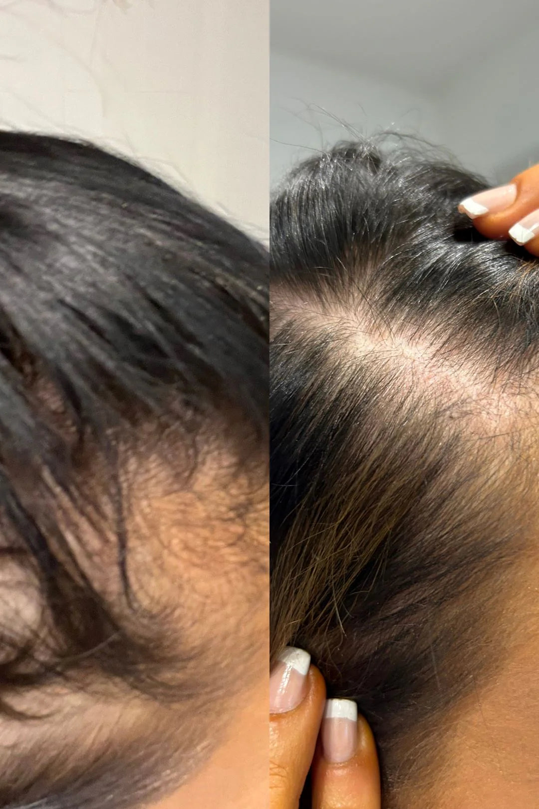 Gloss Hair Growth Shampoo & Conditioner Duo - Minis