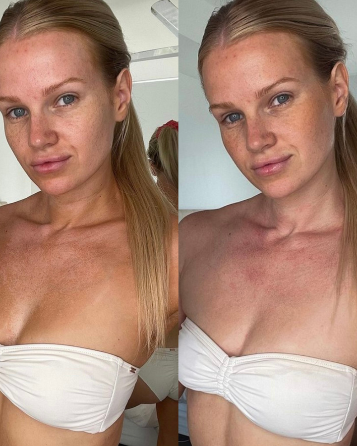 Tan Eraser | Tan Removal Mousse
